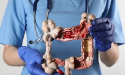 The Importance of Colorectal Cancer Screening in Singapore