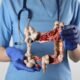 The Importance of Colorectal Cancer Screening in Singapore