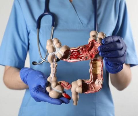The Importance of Colorectal Cancer Screening in Singapore