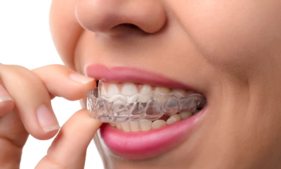 How to Straighten Teeth at Home with Aligners