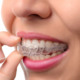 How to Straighten Teeth at Home with Aligners